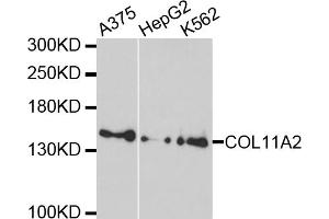 Western blot analysis of extracts of various cell lines, using COL11A2 antibody. (COL11A2 Antikörper)