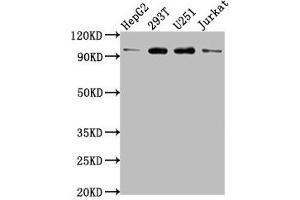 Western Blot Positive WB detected in: HepG2 whole cell lysate, 293T whole cell lysate, U251 whole cell lysate, Jurkat whole cell lysate All lanes: KPNB1 antibody at 1:2000 Secondary Goat polyclonal to rabbit IgG at 1/50000 dilution Predicted band size: 98, 82 kDa Observed band size: 98 kDa (KPNB1 Antikörper  (AA 9-214))