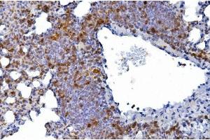 IHC analysis of CD226 using anti-CD226 antibody (ABIN7601264). (CD226 Antikörper  (AA 31-333))