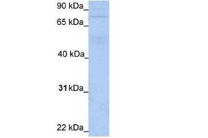 WB Suggested Anti-JPH3 Antibody Titration:  1.