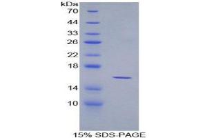 SDS-PAGE (SDS) image for Osteoglycin (OGN) (AA 180-298) protein (His tag) (ABIN1171075)