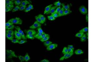 Immunofluorescence staining of HepG2 cells with ABIN7154588 at 1:133, counter-stained with DAPI.