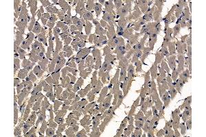 ABIN7097001 and ABIN7101068 at 1/100 staining rat heart tissue by IHC-P. (SASS6 Antikörper)