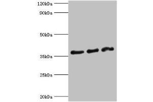 Western blot All lanes: DFFA antibody at 10 μg/mL Lane 1: Hela whole cell lysate Lane 2: 293T whole cell lysate Lane 3: PC-3 whole cell lysate Secondary Goat polyclonal to rabbit IgG at 1/10000 dilution Predicted band size: 37, 30 kDa Observed band size: 37 kDa