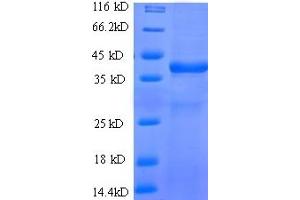 SDS-PAGE (SDS) image for CD7 (CD7) (AA 26-180), (Extracellular) protein (His-SUMO Tag) (ABIN5709243)