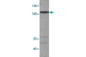Western blot analysis of A-549 cell lysate with ADCY9 polyclonal antibody  at 1:500 dilution. (ADCY9 Antikörper)