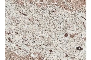 Immunohistochemistry analysis using Rabbit Anti-LRP1 Polyclonal Antibody (ABIN5696040). (LRP1 Antikörper  (AA 160-260) (Atto 594))