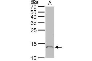 WB Image Profilin 1 antibody detects Profilin 1 protein by Western blot analysis. (PFN1 Antikörper)