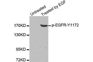 Western blot analysis of extracts from A431 cells, using Phospho-EGFR-Y1172 antibody. (EGFR Antikörper  (pTyr1172))