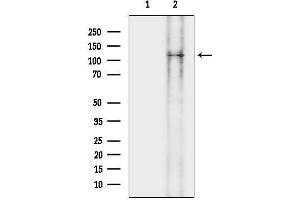 Western blot analysis of lysates from rat brain, using LMTK3 Antibody.