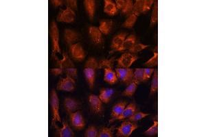 Immunofluorescence analysis of C6 cells using INPP5E antibody (ABIN7267883) at dilution of 1:100. (INPP5E Antikörper  (AA 510-630))