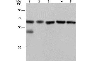 Western Blot analysis of Jurkat cell and Human brain malignant glioma tissue, PC3, K562 and A549 cell using NUP62 Polyclonal Antibody at dilution of 1:300 (NUP62 Antikörper)