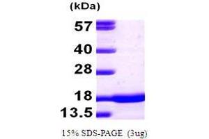 Figure annotation denotes ug of protein loaded and % gel used. (SNCA Protein (AA 1-140))