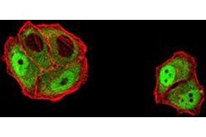 Immunofluorescence analysis of Hela cells using DDX1 mouse mAb (green). (DDX1 Antikörper  (AA 642-740))