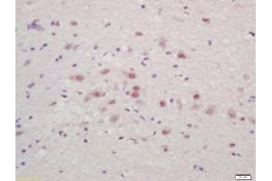 Formalin-fixed and paraffin embedded mouse brain labeled with Anti-ZNF231 Polyclonal Antibody, Unconjugated (ABIN727145) at 1:200 followed by conjugation to the secondary antibody and DAB staining (Bassoon Antikörper  (AA 2901-3000))