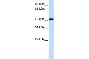 WB Suggested Anti-DGAT2L4 Antibody Titration:  0. (AWAT2 Antikörper  (C-Term))