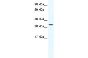 Western Blotting (WB) image for anti-SRY (Sex Determining Region Y)-Box 12 (SOX12) antibody (ABIN2460695) (SOX12 Antikörper)