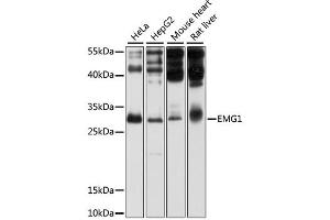 Western blot analysis of extracts of various cell lines, using EMG1 antibody (ABIN1875902) at 1:1000 dilution. (EMG1 Antikörper)