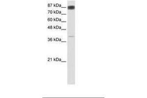 Image no. 1 for anti-Nuclear Factor of Activated T-Cells, Cytoplasmic, Calcineurin-Dependent 4 (NFATC4) (AA 241-290) antibody (ABIN6736168) (NFATC4 Antikörper  (AA 241-290))