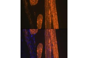 Immunofluorescence analysis of rat skeletal muscle using α-Actin-1  Rabbit mAb (ABIN1682816, ABIN7101454, ABIN7101455 and ABIN7101456) at dilution of 1:100 (40x lens). (Actin (Alpha-Actin) Antikörper)