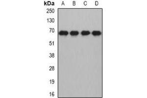 Western blot analysis of MTF-2 expression in HL60 (A), HepG2 (B), mouse brain (C), rat brain (D) whole cell lysates. (MTF2 Antikörper)