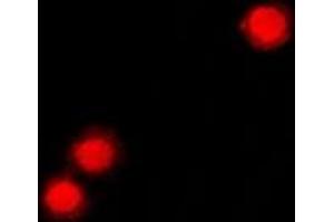 Immunofluorescent analysis of ZNF195 staining in A549 cells. (ZNF195 Antikörper)