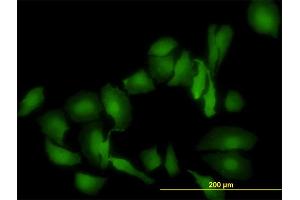 Immunofluorescence of monoclonal antibody to LGALS1 on HeLa cell. (LGALS1/Galectin 1 Antikörper  (AA 1-135))