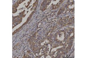 IHC analysis of FATP3/SLC27A3 using anti-FATP3/SLC27A3 antibody (ABIN7600438).