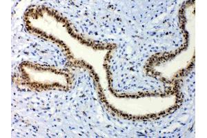 IHC analysis of ETV6/Tel using anti-ETV6/Tel antibody .