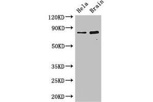Western Blot Positive WB detected in: Hela whole cell lysate, Mouse brain tissue All lanes: DACH1 antibody at 2. (ING3 Antikörper  (AA 51-223))