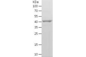 Western Blotting (WB) image for Endoglin (ENG) (AA 394-581) protein (His-IF2DI Tag) (ABIN7122768) (Endoglin Protein (ENG) (AA 394-581) (His-IF2DI Tag))