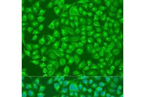 Immunofluorescence analysis of U2OS cells using SLC12A6 Polyclonal Antibody at dilution of 1:100. (SLC12A6 Antikörper)