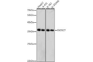Western blot analysis of extracts of various cell lines, using EXOSC7 antibody (ABIN7267064) at 1:1000 dilution. (EXOSC7 Antikörper)