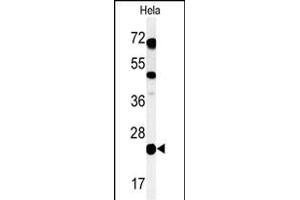 Western blot analysis of C Antibody (C-term) (ABIN650955 and ABIN2840009) in Hela cell line lysates (35 μg/lane). (C16ORF54 Antikörper  (C-Term))
