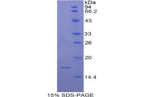 SDS-PAGE analysis of Rat ADAMTS7 Protein. (ADAMTS7 Protein)