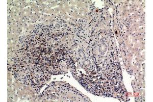 Immunohistochemistry (IHC) analysis of paraffin-embedded Human Liver, antibody was diluted at 1:100. (IFITM1 Antikörper  (N-Term))