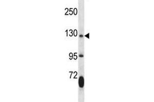 JAK2 antibody western blot analysis in mouse lung tissue lysate. (JAK2 Antikörper  (AA 666-694))