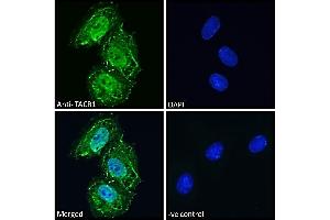 (ABIN190795) Immunofluorescence analysis of paraformaldehyde fixed Neuro2a cells, permeabilized with 0. (TACR1 Antikörper  (Internal Region))