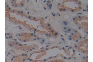 Immunohistochemistry (IHC) image for anti-Vitamin D-Binding Protein (GC) (AA 395-474) antibody (ABIN7444064)