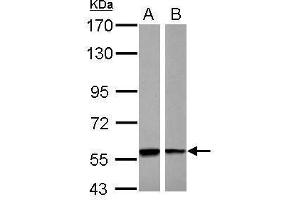 WB Image Sample (30 ug of whole cell lysate) A: A431 B: Raji 7. (PHGDH Antikörper)