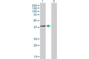 Western Blot analysis of ARMC1 expression in transfected 293T cell line by ARMC1 MaxPab polyclonal antibody. (ARMC1 Antikörper  (AA 1-282))