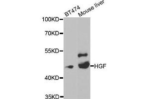 Western blot analysis of extracts of various cell lines, using HGF antibody. (HGF Antikörper  (AA 30-285))