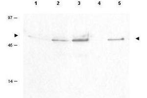 Western blot using  Affinity Purified anti-Cyclin B1 pS126 antibody shows detection of a band ~48 kDa corresponding to phosphorylated human Cyclin B1 (arrowheads) in various whole cell lysates. (Cyclin B1 Antikörper  (pSer126))