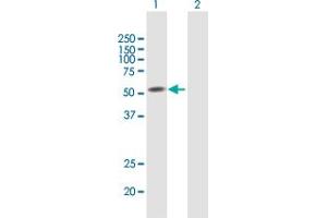 Western Blot analysis of SEMA3D expression in transfected 293T cell line by SEMA3D MaxPab polyclonal antibody. (SEMA3D Antikörper  (AA 1-416))
