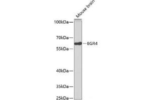 Western blot analysis of extracts of Mouse brain using EGR4 Polyclonal Antibody. (EGR4 Antikörper)