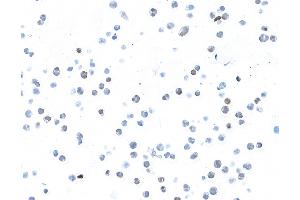 anti-B-Cell CLL/lymphoma 6 (BCL6) (AA 375-425) antibody