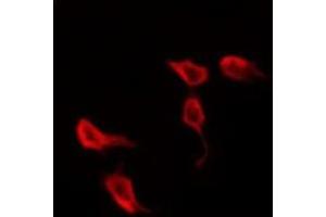 ABIN6278696 staining Hela by IF/ICC. (VZV Protein kinase ORF47 Antikörper)