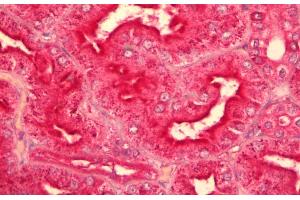 Immunohistochemistry (IHC) image for anti-Guanine Nucleotide Binding Protein (G Protein), Q Polypeptide (GNAQ) (AA 162-175) antibody (ABIN625823)