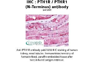 Image no. 1 for anti-Parathyroid Hormone 1 Receptor (PTH1R) (Extracellular Domain), (N-Term), (pThr1) antibody (ABIN1738580) (PTH1R Antikörper  (Extracellular Domain, N-Term, pThr1))
