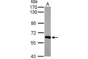 Western Blot analysis: AP19061PU-N PPP3CB antibody staining of Mouse Brain whole cell lysate, 7. (PPP3CB Antikörper)
